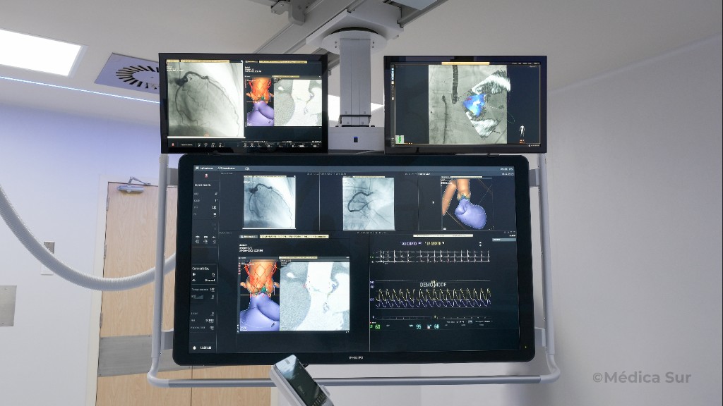 Monitores de Hemodinamia en Médica Sur